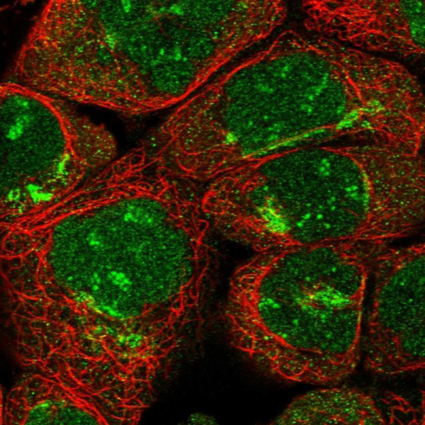Anti-ARFIP2