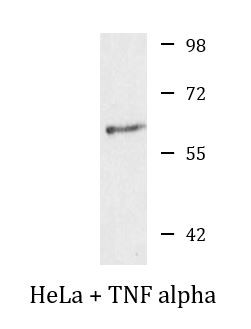 Anti-phospho-NFkB p65 (Ser276)