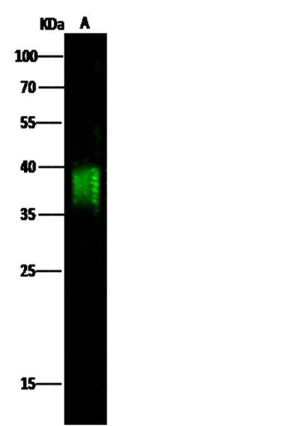 Anti-CD84/SLAMF5 Monoclonal Recombinant Antibody