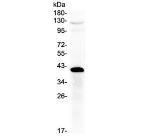 Anti-HSD17B1
