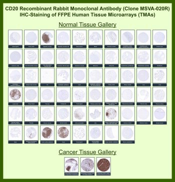 Anti-CD20 for IHC / MS4A1, clone MSVA-020R