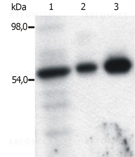 Anti-Fyn Monoclonal Antibody (Clone:FYN-01)