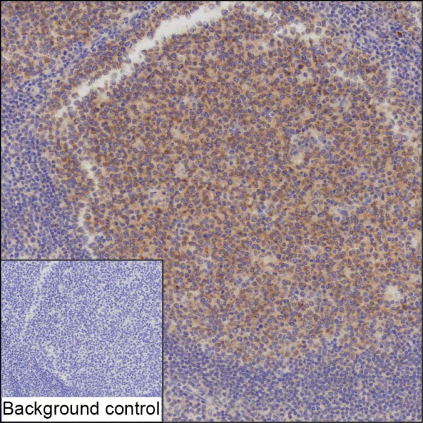 Anti-SERPINA9