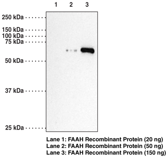 Anti-Fatty Acid Amide Hydrolase