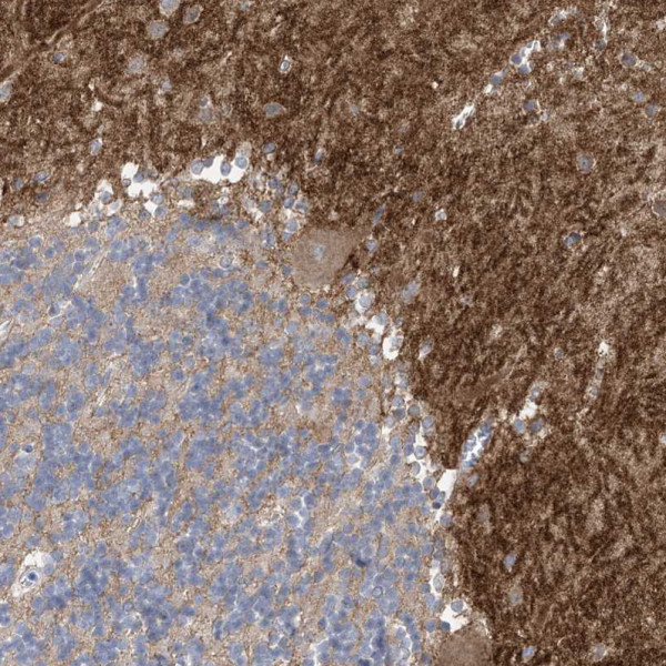 Anti-TTYH1