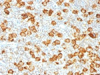 Anti-CD30 / TNFRSF8 (Hodgkin &amp; Reed-Sternberg Cell Marker) (clone: Ki-1/1505R) (recombinant rabbit m