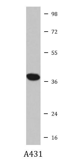 Anti-DNA polymerase beta