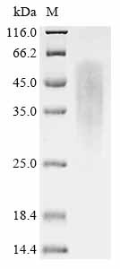 RAD51-associated protein 1 (RAD51AP1), human, recombinant
