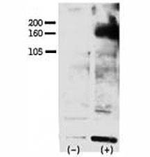 Anti-phospho-ERBB4 (Tyr1162)