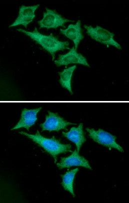 Anti-Enolase1/2, clone 1G7