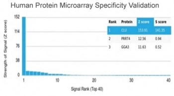 Anti-Clusterin / Apolipoprotein J / APO-J, clone CLU/4724