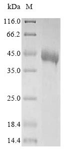 Tomoregulin-1 (TMEFF1), partial, human, recombinant