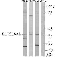 Anti-SLC25A31