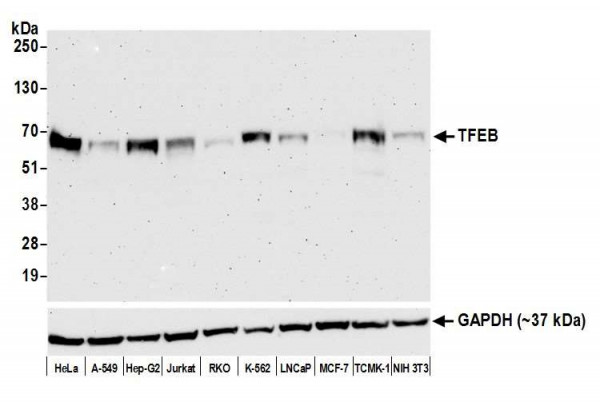 Anti-TFEB Recombinant Rabbit Monoclonal