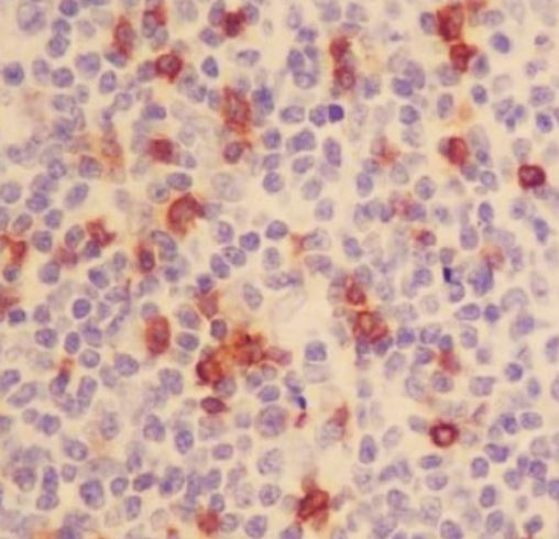 Anti-CD103 / Integrin alpha E