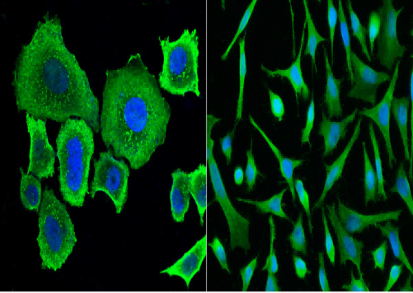 Anti-SerpinA8/Angiotensinogen/AGT Monoclonal Recombinant Antibody