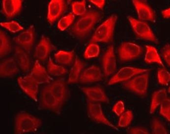 Anti-IL18 binding protein