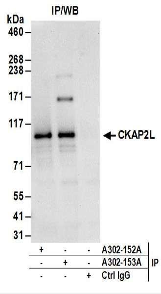 Anti-CKAP2L