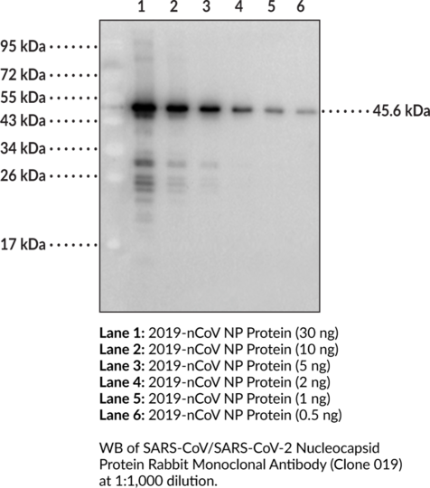 Anti-SARS-CoV/SARS-CoV-2 Nucleocapsid Protein Rabbit (Clone 019)