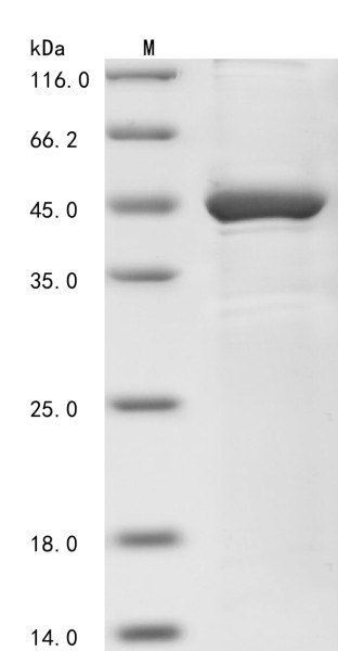 Methyl-CpG-binding domain protein 2 (MBD2), partial, human, recombinant