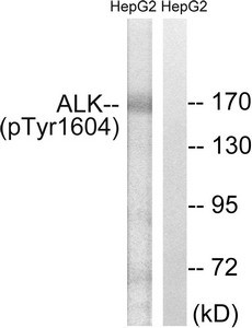 Anti-Phospho-ALK (Tyr1604)
