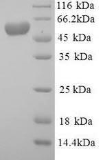 E3 ubiquitin-protein ligase Mdm2 (Mdm2), mouse, recombinant