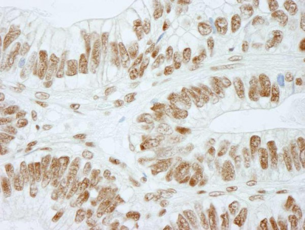Anti-RbBP5 (IHC)
