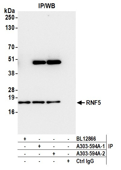 Anti-RNF5