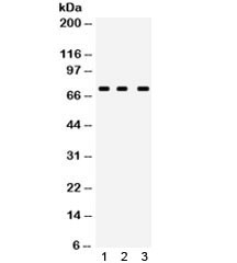 Anti-ABCG5