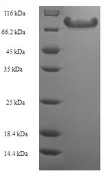 Angiopoietin-related protein 2 (ANGPTL2), human, recombinant