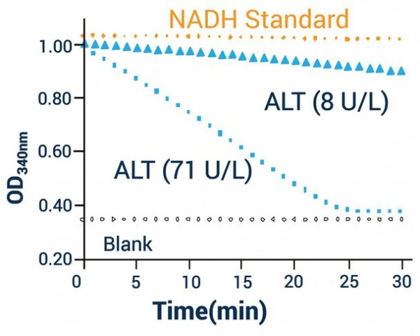 Alanine Transaminase Assay Kit