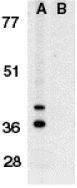 Anti-Bnip3L