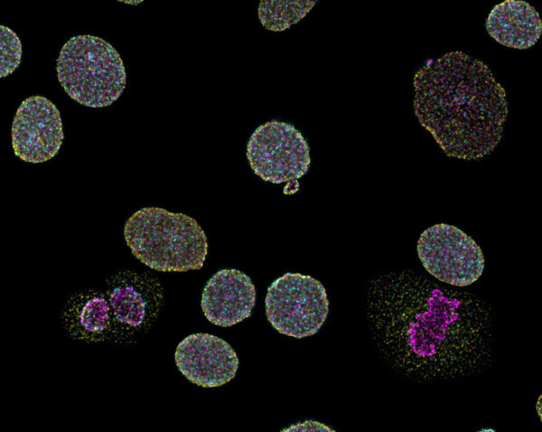 Naveni Triflex Cell MR