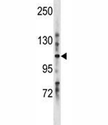 Anti-LRIG1