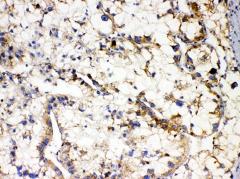 Anti-APOL1 / Apolipoprotein L1