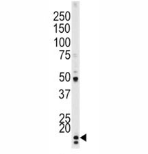 Anti-p21 / CDKN1A (pT145)