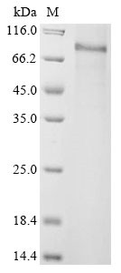 Disintegrin and metalloproteinase domain-containing protein 33 (ADAM33), partial, human, recombinant