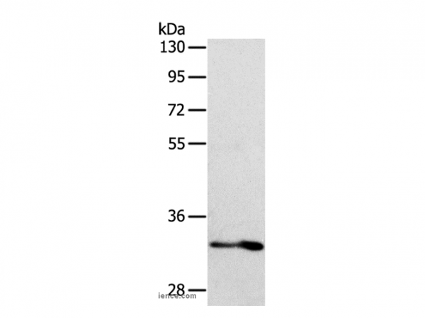 Anti-IL1RL1