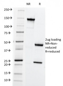 Anti-HLA-ABC (MHC I), clone SPM419