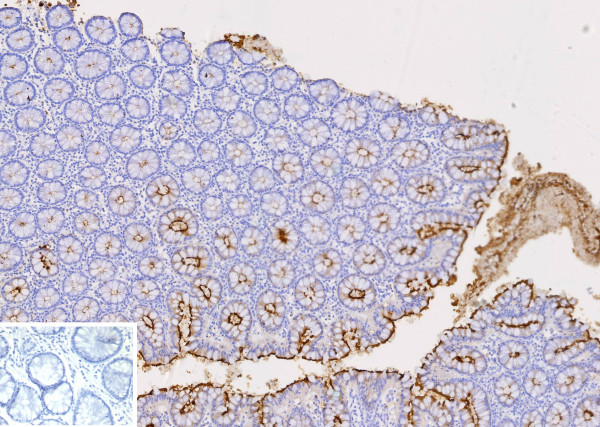 Anti-CEACAM1 (CEA Cell Adhesion Molecule 1) / CD66a, clone CEACAM1/12659