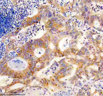 Anti-SLC25A12 / ARALAR1, clone 30S67