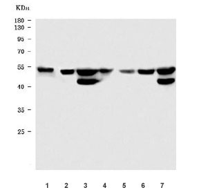 Anti-STK24 / Serine/threonine-protein kinase 24 / MST-3