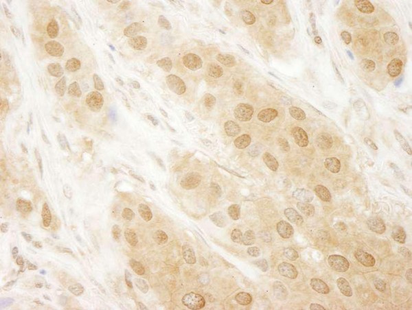 Anti-DJ-1 (IHC)