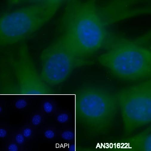 Anti-Recombinant PDK1, clone A325