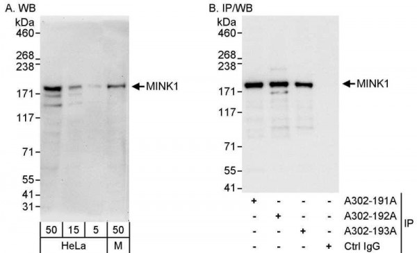 Anti-MINK1