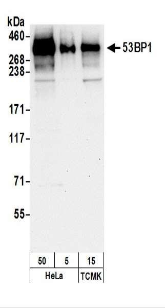 Anti-53BP1