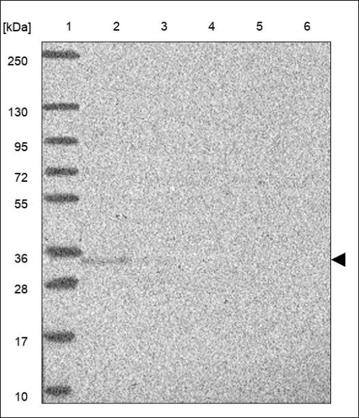 Anti-CTDSP1