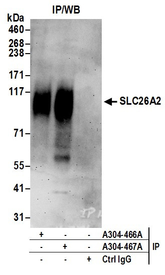 Anti-SLC26A2
