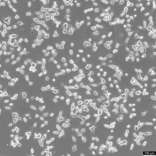 LNCaP Cells
