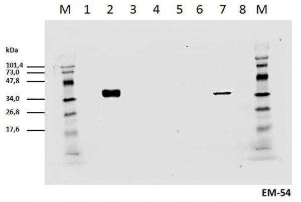 Anti-phospho-CD3 zeta (Tyr142), clone EM-54